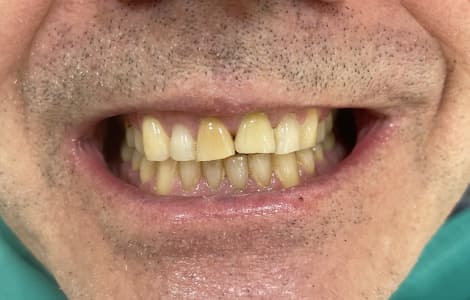 Hans Udink voor behandeling